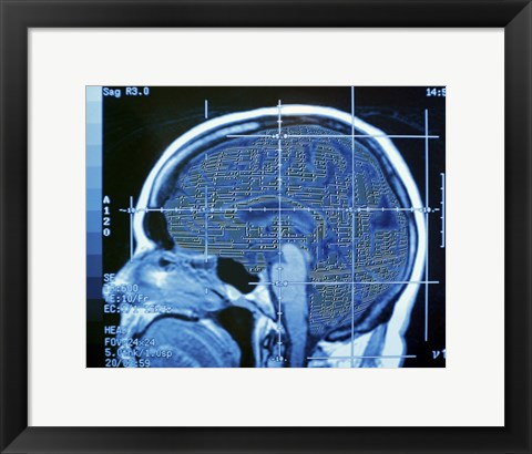 Framed Close-up of an MRI scan of the human brain Print