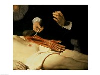 The Anatomy Lesson of Dr. Nicolaes Tulp, 1632 (arm detail) Fine Art Print