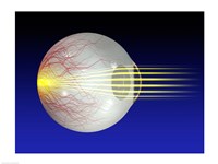 Close-up of the human eyeball - various sizes