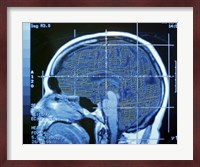 Close-up of an MRI scan of the human brain Fine Art Print
