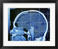 Close-up of an MRI scan of the human brain Fine Art Print