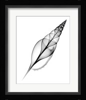 Tibia, Martin's X-Ray Framed Print
