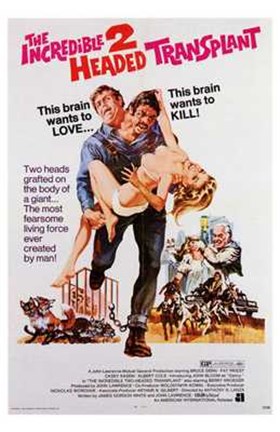 Framed Incredible Two-Headed Transplant Print