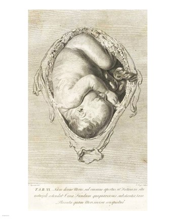 Framed William Hunter Print