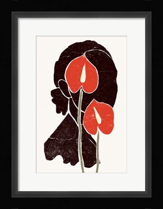 Framed Anthurium Print