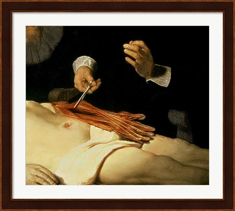 Framed Anatomy Lesson of Dr. Nicolaes Tulp, 1632 (arm detail) Print