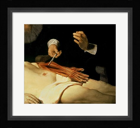 Framed Anatomy Lesson of Dr. Nicolaes Tulp, 1632 (arm detail) Print