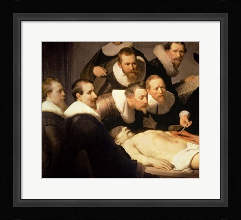 Framed Anatomy Lesson of Dr. Nicolaes Tulp, 1632 (detail) Print