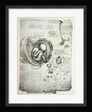 Framed Human Fetus in the Womb Print
