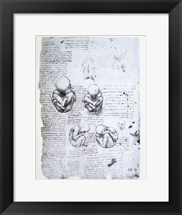 Framed Five Views of a Fetus in the Womb Print