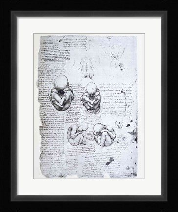 Framed Five Views of a Fetus in the Womb Print