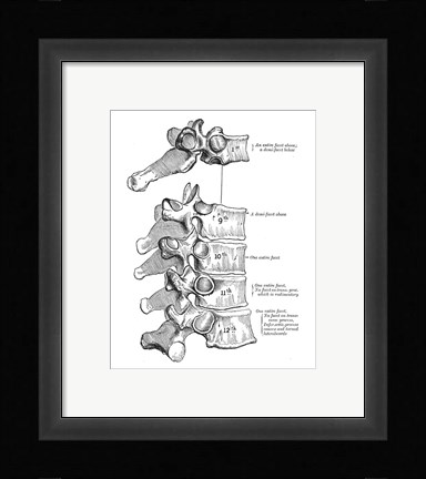 Framed Vertebrae Diagram Print