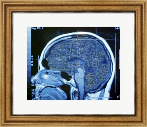 Framed Close-up of an MRI scan of the human brain Print